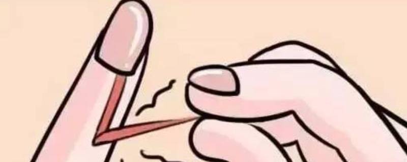 手起倒刺吃什么维生素