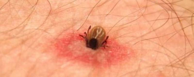 房间里发现了蜱虫还能住吗